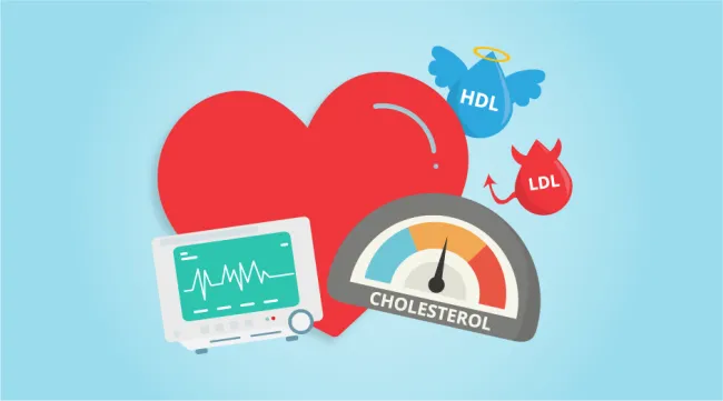 Particulele LDL „small-dense” (sdLDL) – factor de risc independent pentru ateroscleroză