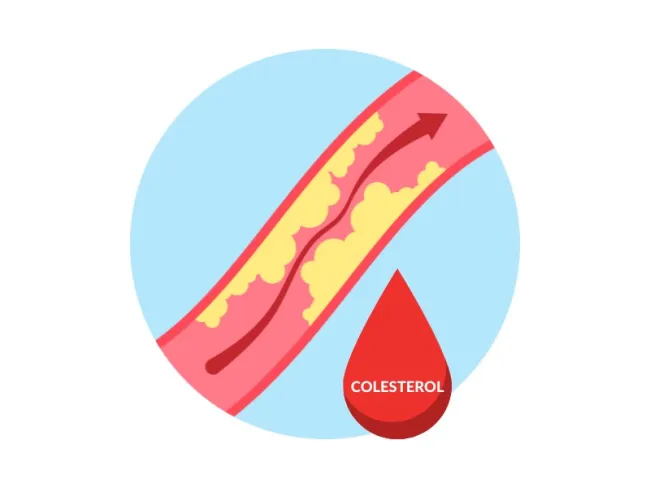 Mituri despre colesterol