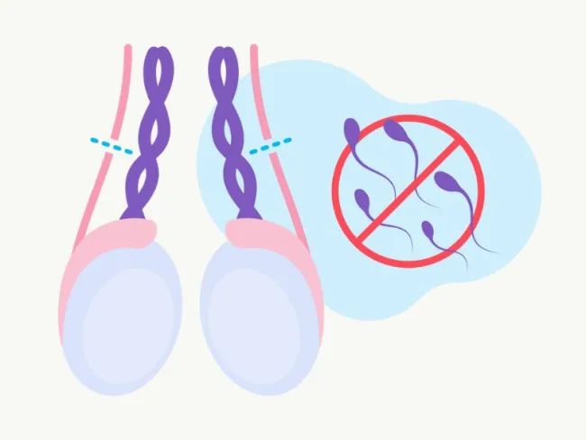Azoospermie și impactul asupra fertilității