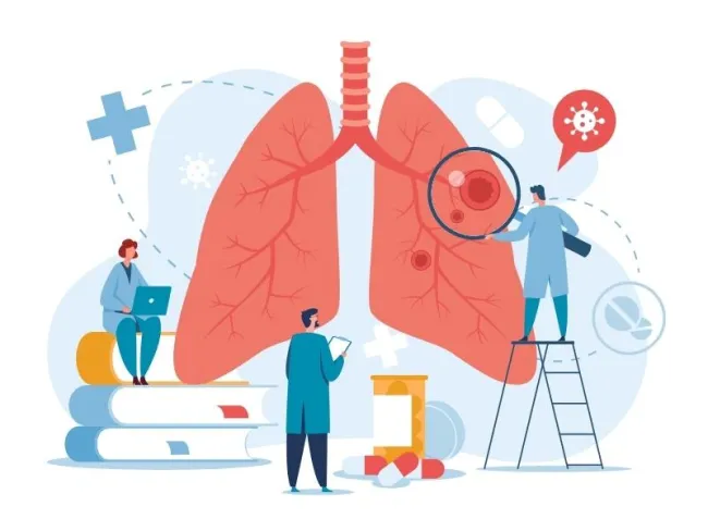 Cancer pulmonar: epidemiologie și diagnostic