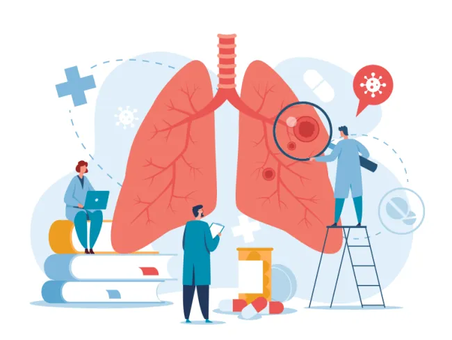 Informații utile despre “Chlamydia pneumoniae: Anticorpi IgG, IgA”
