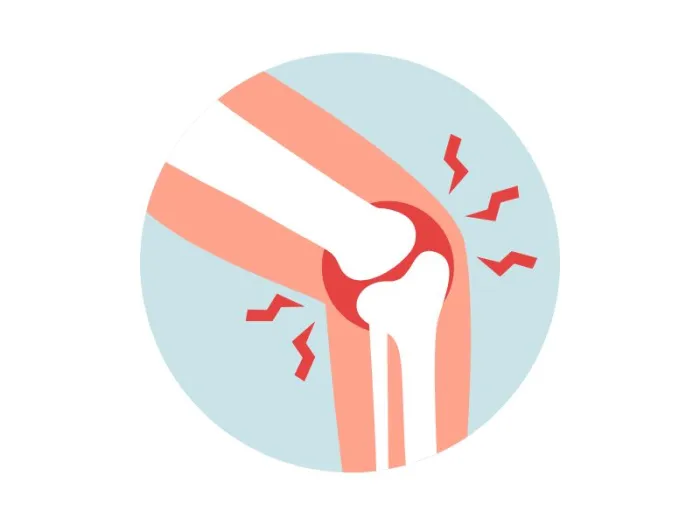 artroza, ce este artroza, artroza simptome, artroza genunchi, artroza tratament, tratament artroza, simptome artroza, artroza genunchiului, tratament artroza maini, tipuri de artroza, antiinflamatoare pentru artroza, pastile pentru artroza, analize artroza, artroza umar, artroza cervicala, injectii pentru artroza