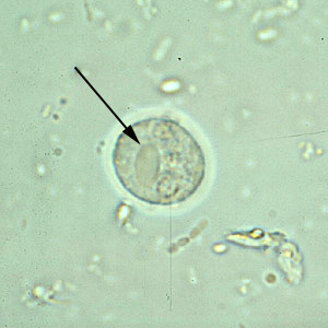 chisturi giardia in scaun