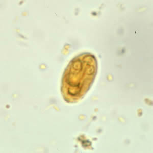 giardia synevo)