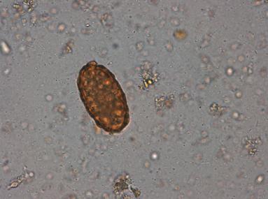 analiza paraziti intestinali