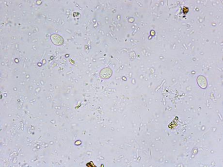 Paraziti în materii fecale 2: viermi intestinali/microsporidii - PCR