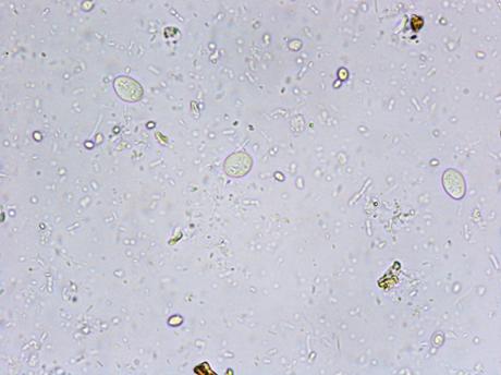 scaun giardia imagenes de boca con papiloma