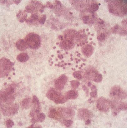 enterococcus spp secretie uretrala