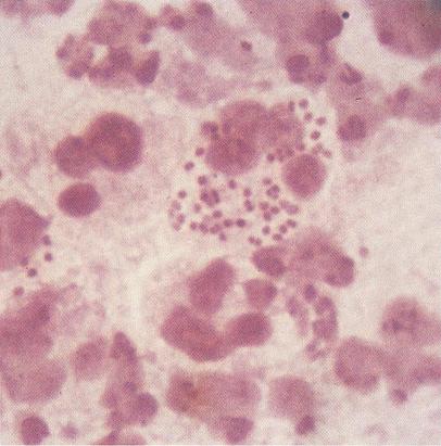 Examen microscopic pe frotiu (preparat proaspăt și/sau colorat) - Synevo