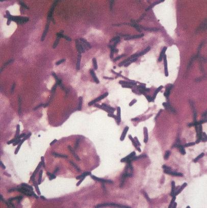Examen microscopic pe frotiu (preparat proaspăt și/sau colorat) - Synevo