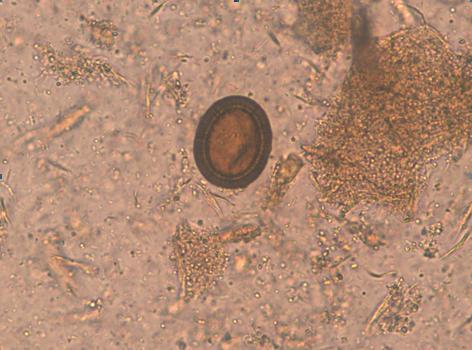 chisturi giardia in scaun