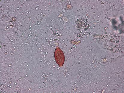 giardia synevo