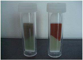 Cancerul de vezica urinara (vezical): Cauze, diagnostic, tratament | microinjectie.ro