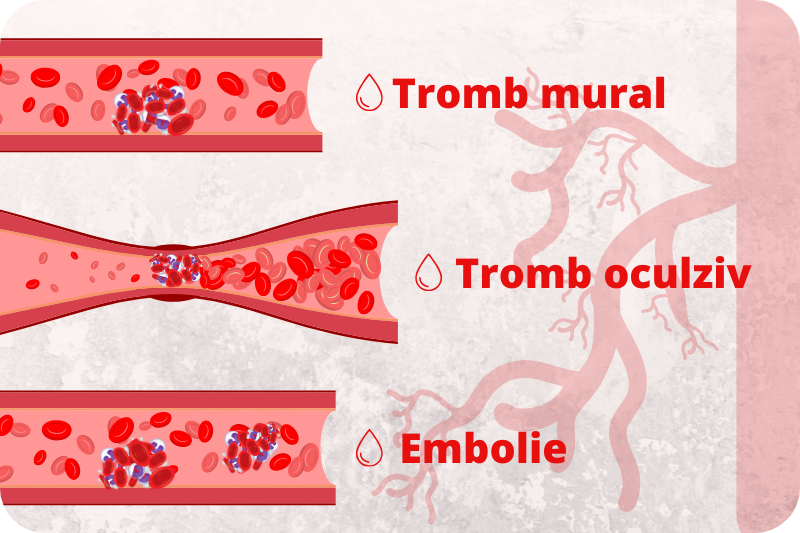tromboza, trombofilie, cheag de sange
