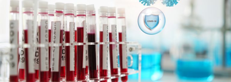 SARS-CoV-2: Detecția anticorpilor IgG în laboratoarele Synevo - Synevo