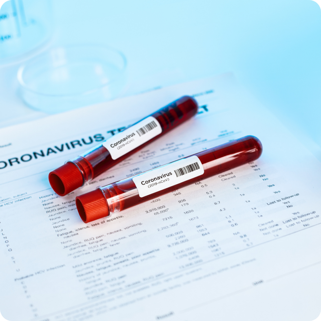 profil imunologic covid-19, anticorpi covid, anticorpi igm igg covid-19, coronavirus test, synevo