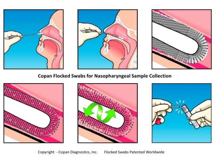 recoltare exsudat nazofaringian, test pcr, test covid-19, gripa