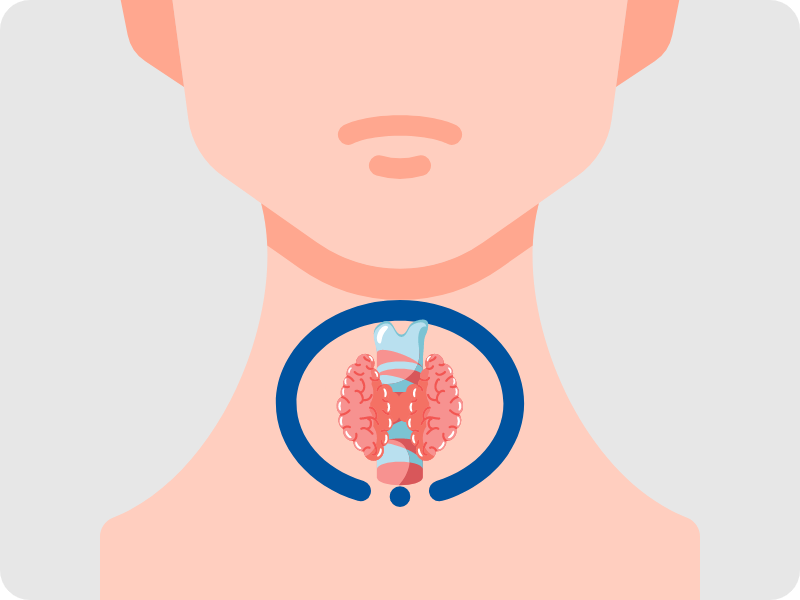 cancer tiroidian, cancerul tiroidian, iodura de potasiu, noduli tiroidieni, tumora maligna