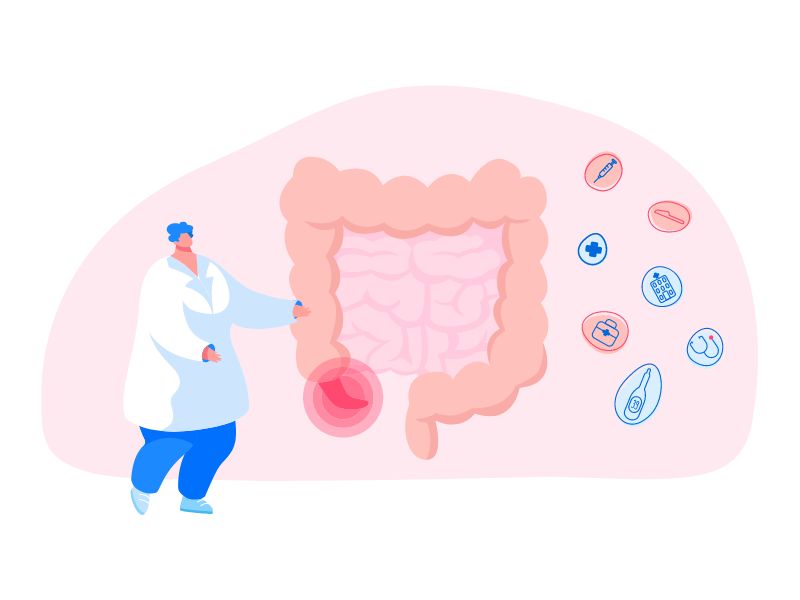 boala crohn, colita ulcerativa, ocluzie intestinala
