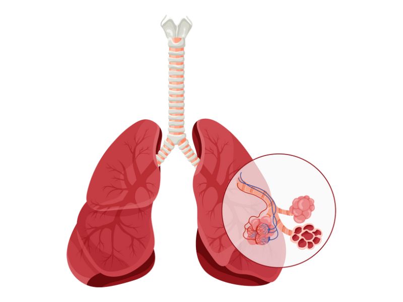 edem pulmonar, soc septic, edem pulmonar acut, bronhodilatatoare, alveole pulmonare, infarctul pulmonar, ventilatia pulmonara