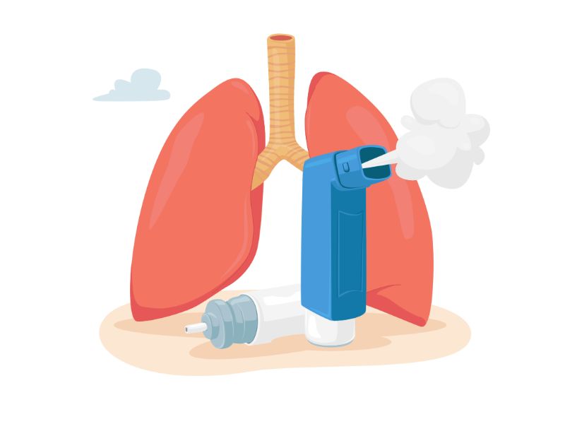 astm bronsic, astm, astm simptome, tratament astm bronsic, boli ale sistemului respirator, criza de astm, analize de sanfe pentru astm bronsic