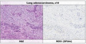 IHC ROS1 - Synevo