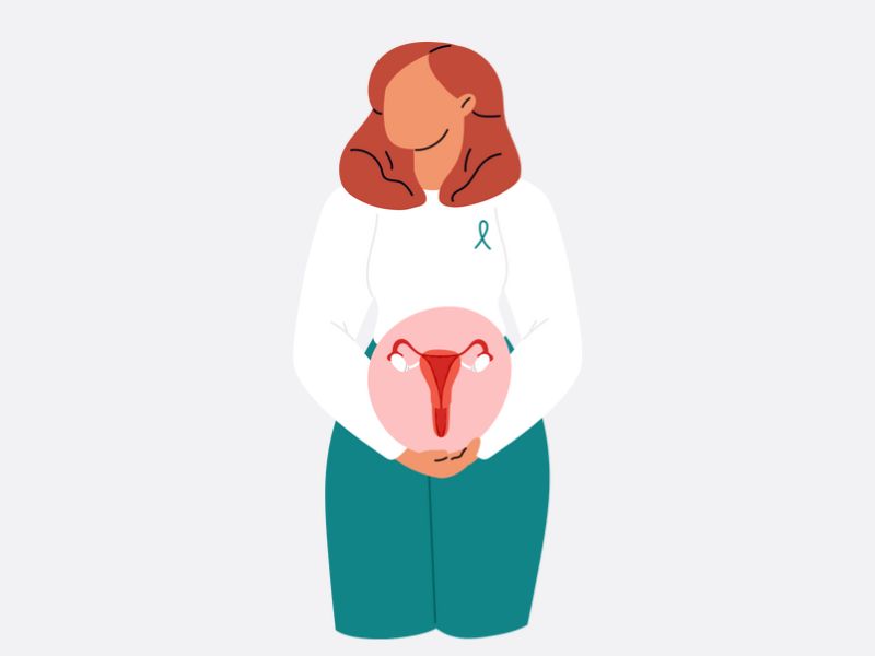 Carcinom ovarian ereditar: patogeneză dincolo de genele BRCA1 și BRCA2 - Synevo