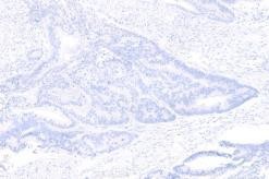 BRAF V600 E 4x