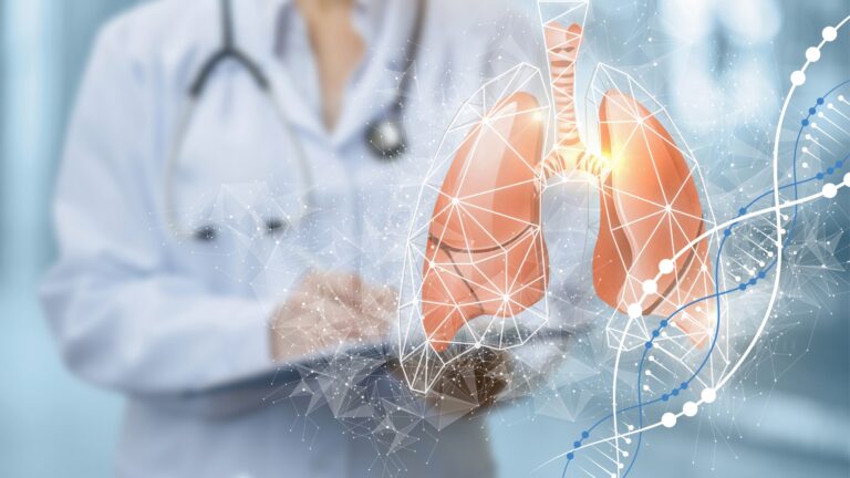 webinar Cancerul bronho-pulmonar