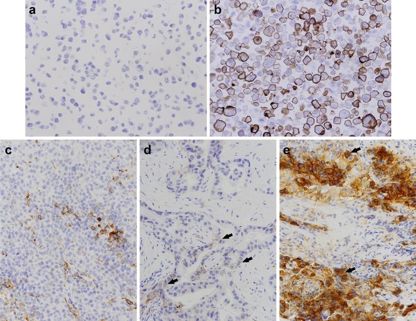Testare IHC – PD-L1 (22C3) - Synevo