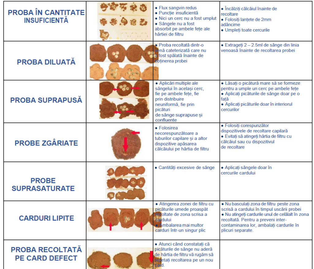 Newborn screening extins (screening metabolic, electroforeza hemoglobinei, tripsina imunoreactivă, G6PDH) - Synevo